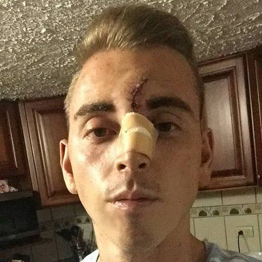 Aparatoso accidente a futbolista boricua en Costa Rica